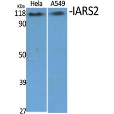 Anti-IARS2 antibody