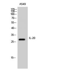 Anti-IL-20 antibody