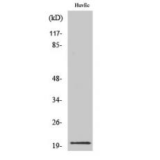 Anti-IL-21 antibody