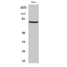 Anti-BARD1 antibody