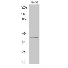 Anti-ChoKB antibody