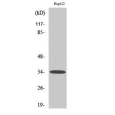 Anti-Chemokine Receptor D6 antibody