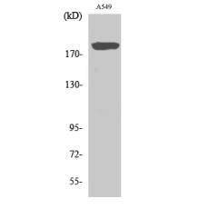 Anti-BIG2 antibody