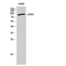 Anti-cGKII antibody