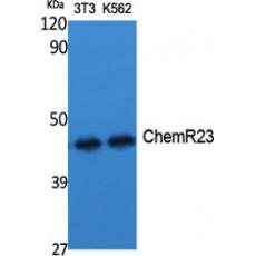 Anti-ChemR23 antibody