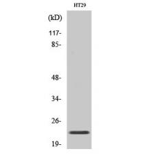 Anti-CHP2 antibody