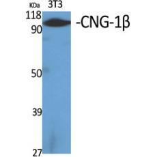 Anti-CNG-1β antibody