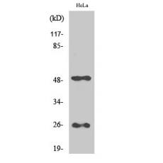Anti-Clusterin antibody