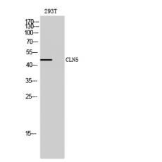 Anti-CLN5 antibody