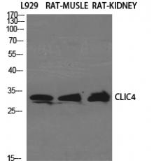 Anti-CLIC4 antibody