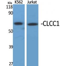 Anti-CLCC1 antibody
