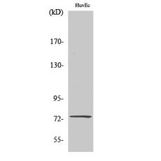 Anti-CLC-KA antibody