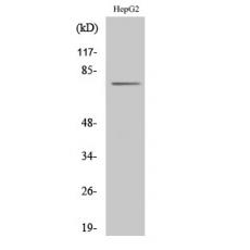 Anti-CLIP4 antibody