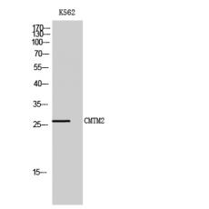 Anti-CMTM2 antibody