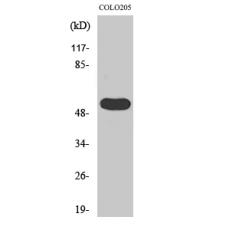 Anti-LPD lipase antibody