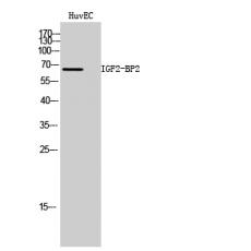 Anti-IGF2-BP2 antibody