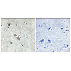 Anti-IFI-56K antibody