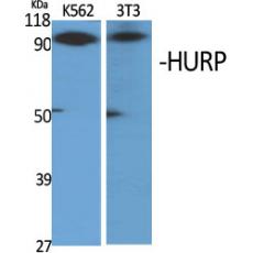 Anti-HURP antibody