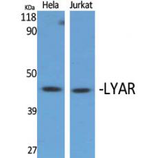 Anti-LYAR antibody