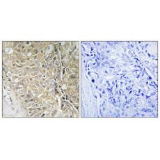 Anti-D55 antibody