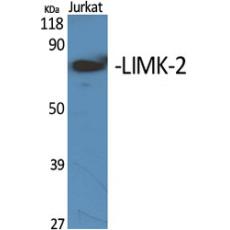 Anti-LIMK-2 antibody