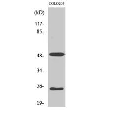 Anti-LRAT antibody