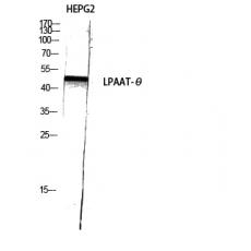 Anti-LPAAT-θ antibody