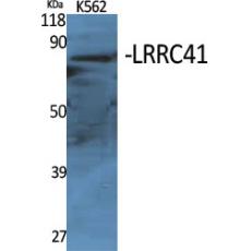 Anti-LRRC41 antibody