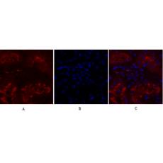 Anti-IGF-IR antibody