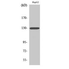 Anti-IL-3Rβ antibody