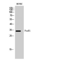 Anti-FoxE1 antibody
