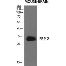 Anti-FRP-2 antibody
