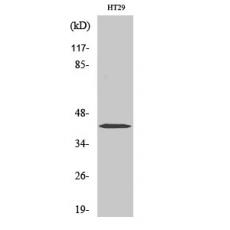 Anti-Fra-1 antibody