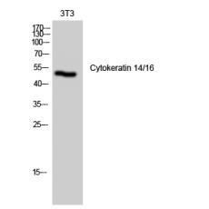 Anti-Cytokeratin 14/16 antibody