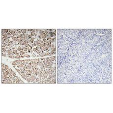 Anti-IGF-I antibody