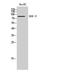 Anti-DGK-β antibody