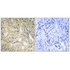Anti-DHA Kinase antibody