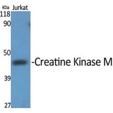 Anti-Creatine Kinase M antibody