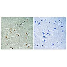 Anti-CREM antibody