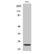 Anti-CRMP-3 antibody