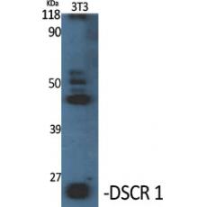 Anti-DSCR 1 antibody