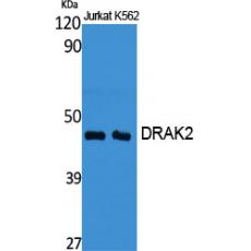 Anti-DRAK2 antibody