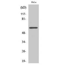 Anti-CYP2U1 antibody