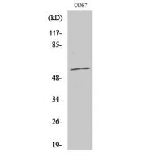 Anti-CYP1A1/2 antibody