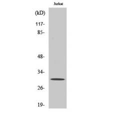Anti-CTDSP1 antibody