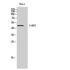 Anti-CtBP2 antibody