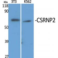 Anti-CSRNP2 antibody