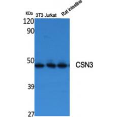 Anti-CSN3 antibody