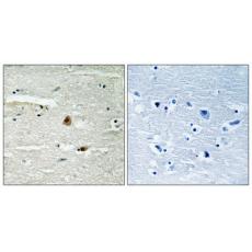 Anti-CSN1 antibody