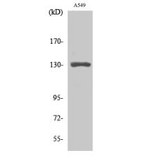 Anti-CRSP130 antibody